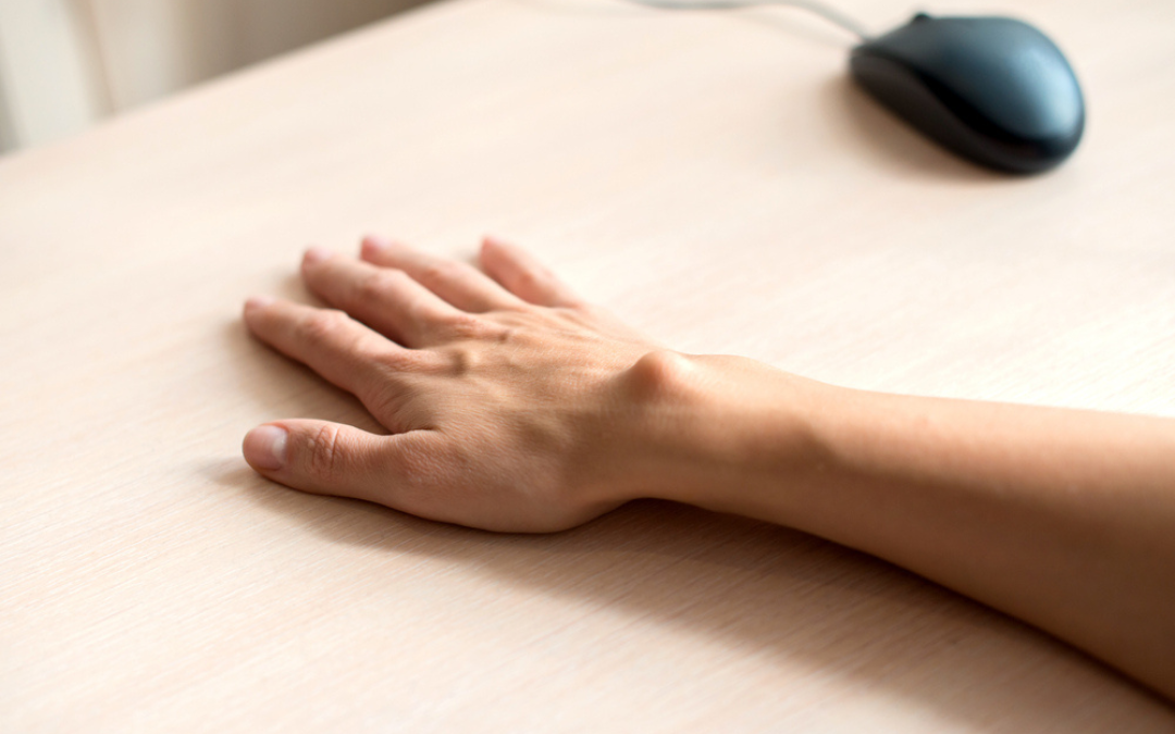 Γάγγλιο καρπού